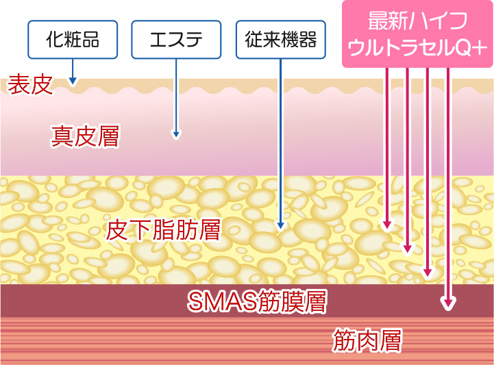 岩手でウルトラセルなら、畑山レディスクリニック